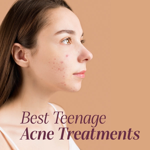 Teenage pimples top best treatments