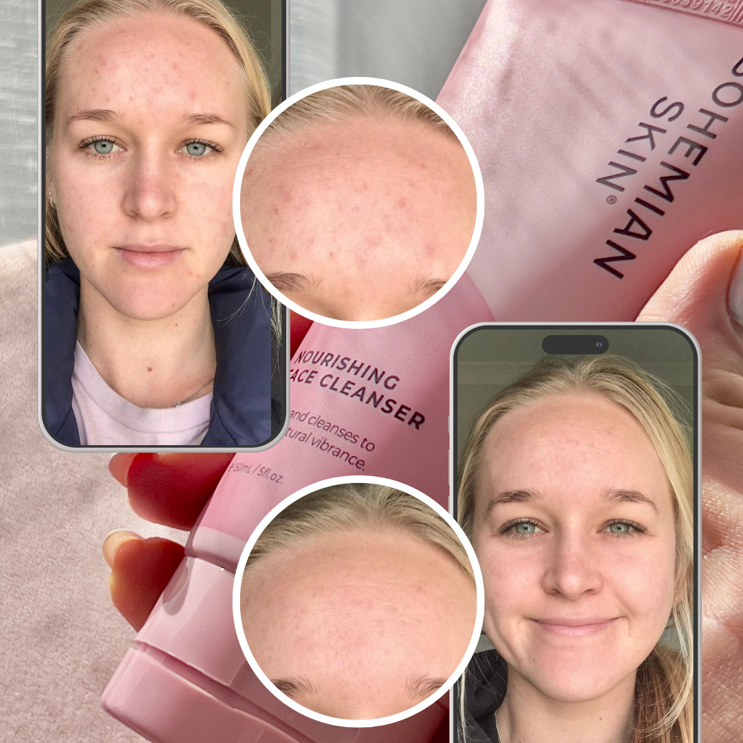 Nourishing Face Cleanser - Premium Cleanser from Bohemian Skin - Just $32! Shop now at Bohemian Skin
