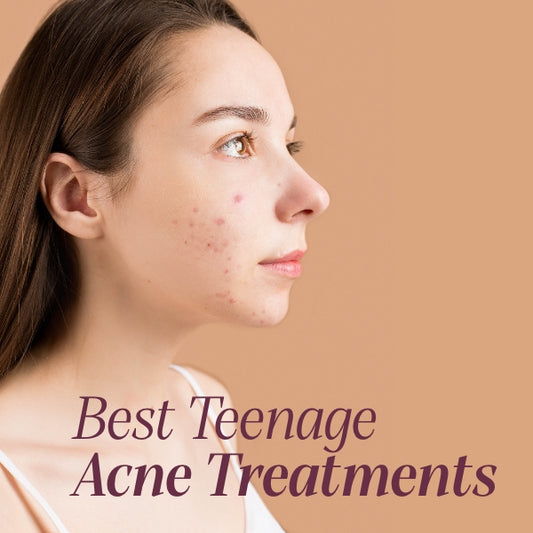 teenage acne treatments that work - best acne treatment for teenage males teenage acne treatment reviews teenage acne forehead best face wash for teenage acne