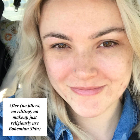 Image of woman with no filters, editing or makeup just healthy skin.